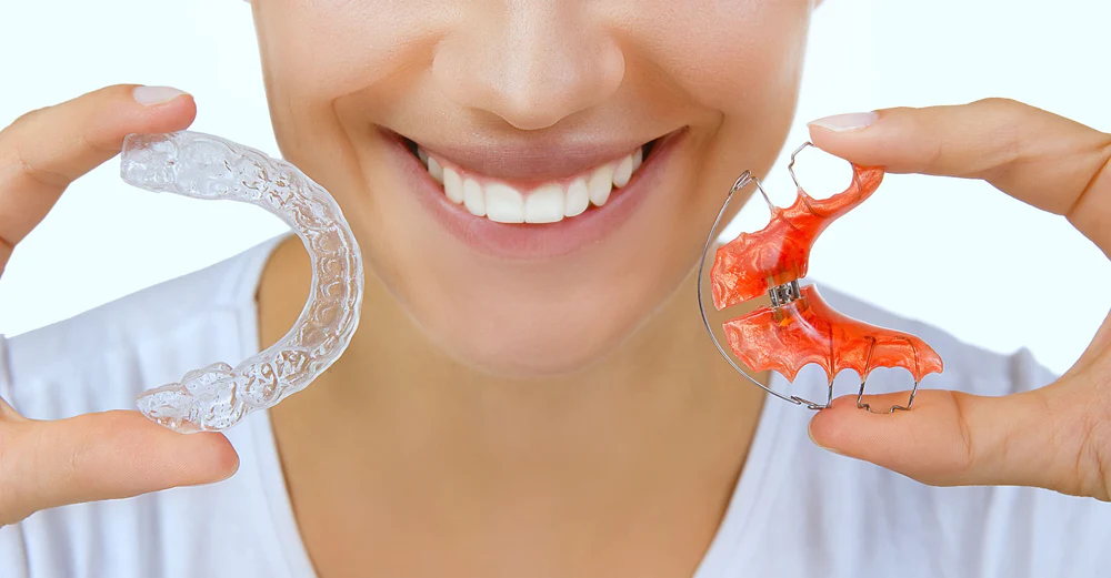 “Making Your Own Retainers with a Mold Kit”